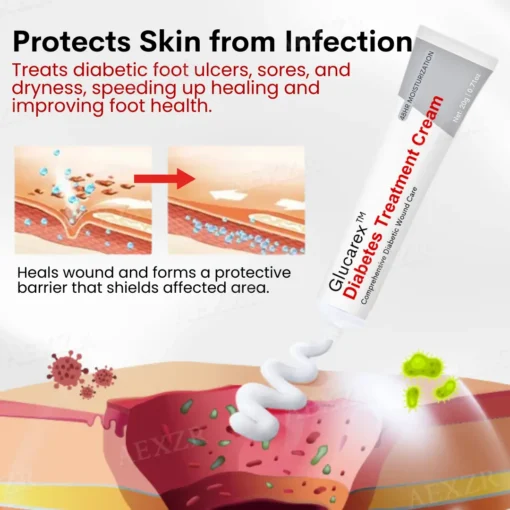 Glucarex™ Diabetes Treatment Cream