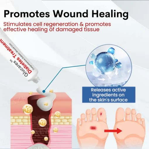 Glucarex™ Diabetes Treatment Cream