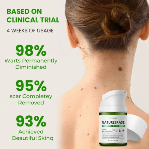 𝗧𝗟𝗢𝗣𝗔® Alligator Oil NatureErase Instant Mole & Spot Cream