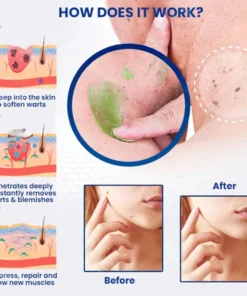 𝗧𝗟𝗢𝗣𝗔® Alligator Oil NatureErase Instant Mole & Spot Cream