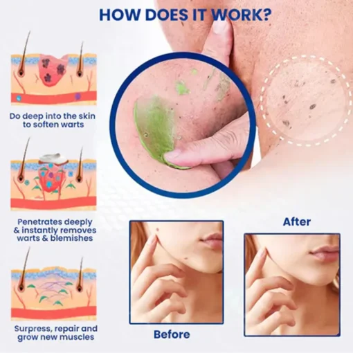 𝗧𝗟𝗢𝗣𝗔® Alligator Oil NatureErase Instant Mole & Spot Cream