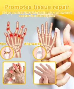 TLOPA® Botulinum Toxin & Bee Venom Pain-Relief Bone Healing Cream