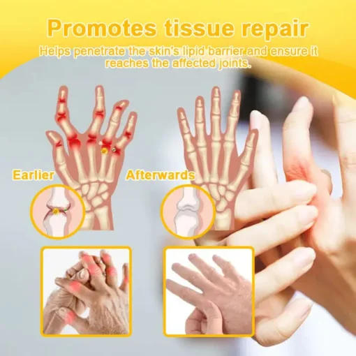 TLOPA® Botulinum Toxin & Bee Venom Pain-Relief Bone Healing Cream