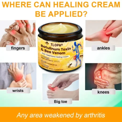 TLOPA® Botulinum Toxin & Bee Venom Pain-Relief Bone Healing Cream