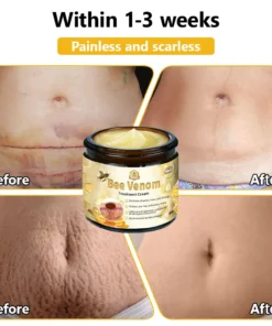 𝗧𝗟𝗢𝗣𝗔® Bee Venom Skin Treatment Cream