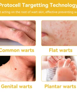 𝗧𝗟𝗢𝗣𝗔® Bee Venom Skin Treatment Cream