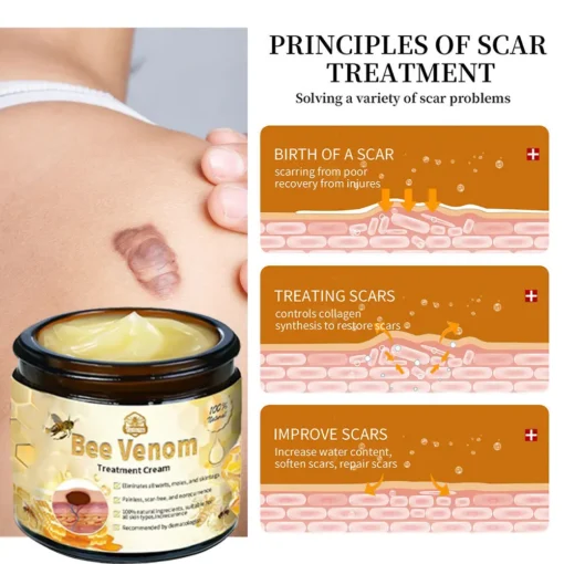 𝗧𝗟𝗢𝗣𝗔® Bee Venom Skin Treatment Cream