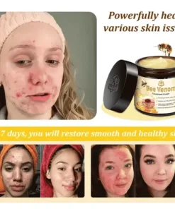 𝗧𝗟𝗢𝗣𝗔® Bee Venom Skin Treatment Cream