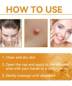 𝗧𝗟𝗢𝗣𝗔® Bee Venom Skin Treatment Cream
