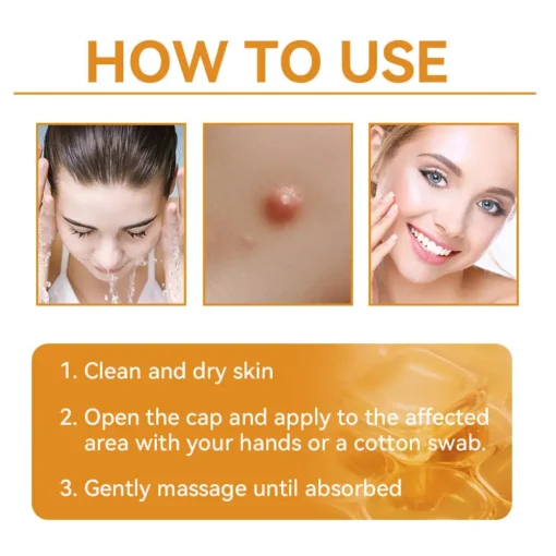 𝗧𝗟𝗢𝗣𝗔® Bee Venom Skin Treatment Cream