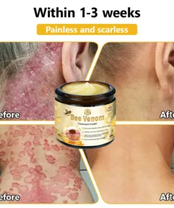 𝗧𝗟𝗢𝗣𝗔® Bee Venom Skin Treatment Cream