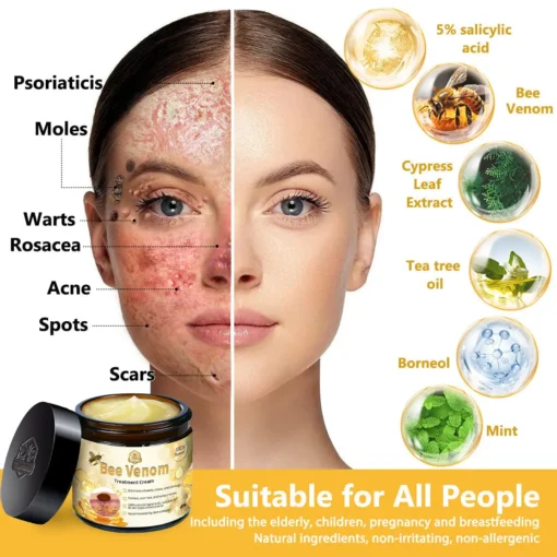 𝗧𝗟𝗢𝗣𝗔® Bee Venom Skin Treatment Cream