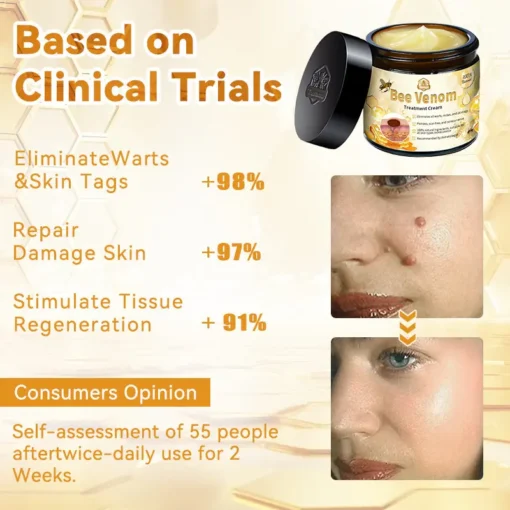 𝗧𝗟𝗢𝗣𝗔® Bee Venom Skin Treatment Cream