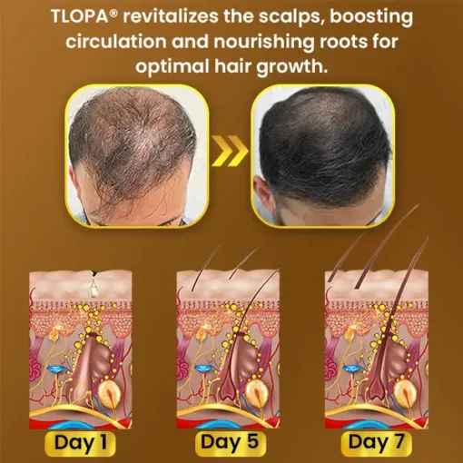 TLOPA® Hair Regrowth Capsules