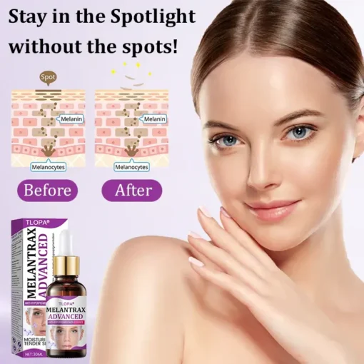 TLOPA® MelantraX Advanced Anti-Hyperpigmentation Essence