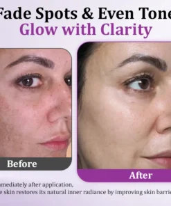 TLOPA® MelantraX Advanced Anti-Hyperpigmentation Essence
