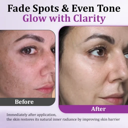 TLOPA® MelantraX Advanced Anti-Hyperpigmentation Essence