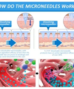 TLOPA® Nano Microneedle Patch with SMGT-GLP-1 & Matrixyl 3000 – Slimming,👨‍⚕️ Skin Tightening, Blood Sugar Support, No Injection, 7-Day Result
