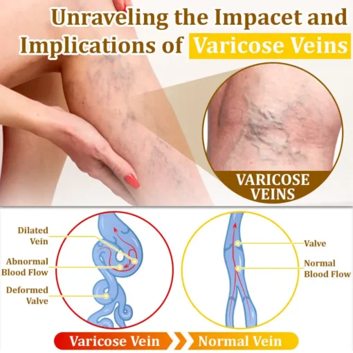𝗧𝗟𝗢𝗣𝗔® Bee VenomSkin Restoration Cream
