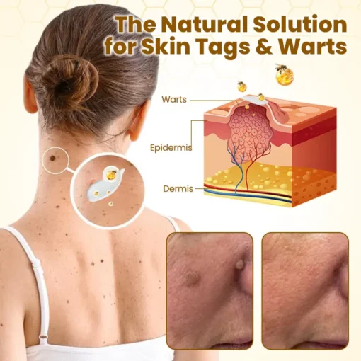𝗧𝗟𝗢𝗣𝗔® Bee VenomSkin Restoration Cream