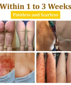 𝗧𝗟𝗢𝗣𝗔® Bee VenomSkin Restoration Cream