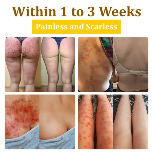 𝗧𝗟𝗢𝗣𝗔® Bee VenomSkin Restoration Cream