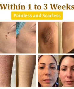 𝗧𝗟𝗢𝗣𝗔® Bee VenomSkin Restoration Cream