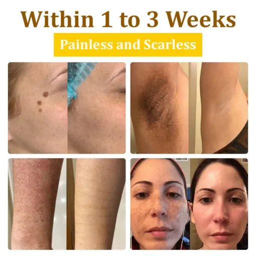 𝗧𝗟𝗢𝗣𝗔® Bee VenomSkin Restoration Cream