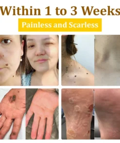𝗧𝗟𝗢𝗣𝗔® Bee VenomSkin Restoration Cream