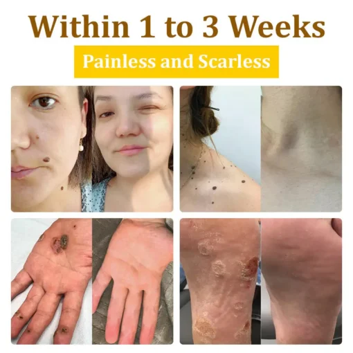 𝗧𝗟𝗢𝗣𝗔® Bee VenomSkin Restoration Cream