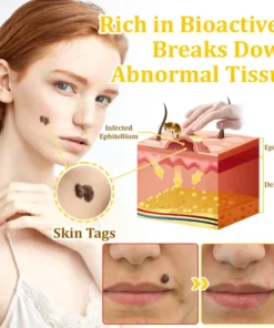 𝗧𝗟𝗢𝗣𝗔® Bee VenomSkin Restoration Cream