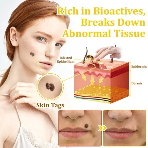 𝗧𝗟𝗢𝗣𝗔® Bee VenomSkin Restoration Cream