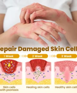 𝗧𝗟𝗢𝗣𝗔® Bee VenomSkin Restoration Cream