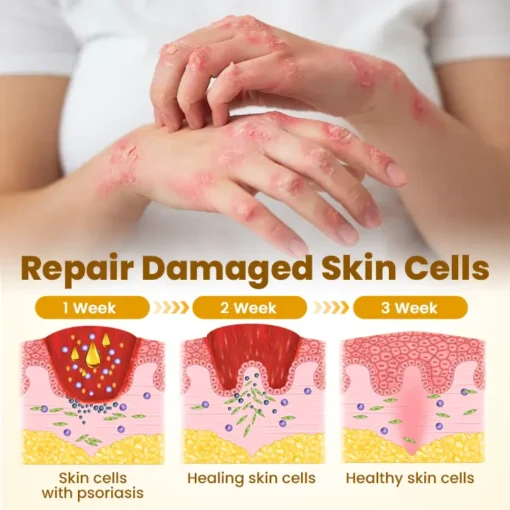 𝗧𝗟𝗢𝗣𝗔® Bee VenomSkin Restoration Cream