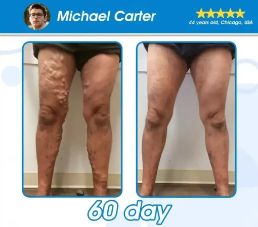TL𝗢𝙿𝙰® 𝐆 𝐋 𝐏-𝟏 𝗠𝗲𝘁𝗮𝗯𝗼𝗹𝗶𝗰 Support – 𝗨𝗹𝘁𝗿𝗮 𝗖𝗼𝗻𝗰𝗲𝗻𝘁𝗿𝗮𝘁𝗲𝗱 𝗟𝗶𝗾𝘂𝗶𝗱