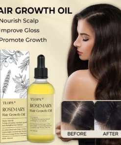 TLOPA® Rosemary Hair Growth Oil