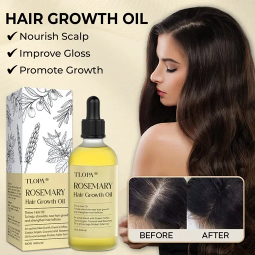 TLOPA® Rosemary Hair Growth Oil