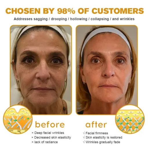 𝐓𝐋𝐎𝐏𝐀® 𝐅𝐀𝐂𝐄 𝐋𝐈𝐅𝐓 𝐒𝐤𝐢𝐧 𝐂𝐚𝐫𝐞 𝐒𝐭𝐢𝐜𝐤