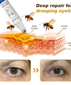 𝐓𝐋𝐎𝐏𝐀® 𝐅𝐀𝐂𝐄 𝐋𝐈𝐅𝐓 𝐒𝐤𝐢𝐧 𝐂𝐚𝐫𝐞 𝐒𝐭𝐢𝐜𝐤